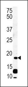 C6orf108 Antibody - RCL Antibody western blot of CEM cell line lysates (35 ug/lane). The RCL antibody detected the RCL protein (arrow).
