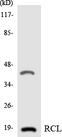C6orf108 Antibody - Western blot analysis of the lysates from 293 cells using RCL antibody.