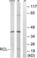 C6orf108 Antibody - Western blot analysis of extracts from K562 cells and Jurkat cells, using RCL antibody.