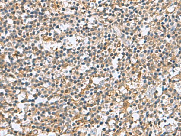 C6orf108 Antibody - Immunohistochemistry of paraffin-embedded Human tonsil tissue  using DNPH1 Polyclonal Antibody at dilution of 1:60(×200)