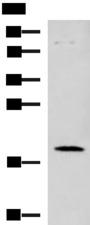 C6orf108 Antibody - Western blot analysis of Human heart tissue lysate  using DNPH1 Polyclonal Antibody at dilution of 1:800