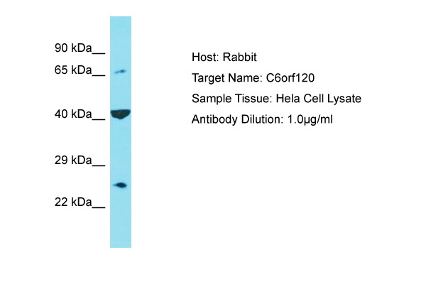 C6orf120 Antibody -  This image was taken for the unconjugated form of this product. Other forms have not been tested.