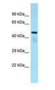 C6orf134 / ATAT1 Antibody - C6orf134 / ATAT1 antibody Western Blot of Rat Kidney.  This image was taken for the unconjugated form of this product. Other forms have not been tested.