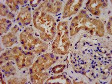 C6orf134 / ATAT1 Antibody - Immunohistochemistry image at a dilution of 1:300 and staining in paraffin-embedded human kidney tissue performed on a Leica BondTM system. After dewaxing and hydration, antigen retrieval was mediated by high pressure in a citrate buffer (pH 6.0) . Section was blocked with 10% normal goat serum 30min at RT. Then primary antibody (1% BSA) was incubated at 4 °C overnight. The primary is detected by a biotinylated secondary antibody and visualized using an HRP conjugated SP system.