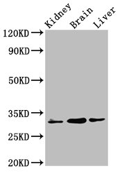 C6orf134 / ATAT1 Antibody - Positive Western Blot detected in Rat kidney tissue, Mouse brain tissue, Mouse liver tissue. All lanes: ATAT1 antibody at 6 µg/ml Secondary Goat polyclonal to rabbit IgG at 1/50000 dilution. Predicted band size: 47, 46, 45, 38, 37, 36, 34 KDa. Observed band size: 47 KDa