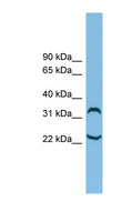 C6orf134 / ATAT1 Antibody - ATAT1 / C6orf134 antibody Western blot of ACHN lysate. This image was taken for the unconjugated form of this product. Other forms have not been tested.