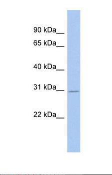 C6orf140 / GLYATL3 Antibody - Western blot of Human Fetal Brain. GLYATL3 antibody dilution 1.0 ug/ml.  This image was taken for the unconjugated form of this product. Other forms have not been tested.