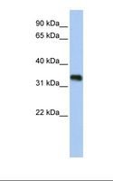 C6orf140 / GLYATL3 Antibody - Fetal brain lysate. Antibody concentration: 1.0 ug/ml. Gel concentration: 12%.  This image was taken for the unconjugated form of this product. Other forms have not been tested.