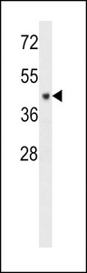 C6orf150 / MB21D1 Antibody - CF150 Antibody western blot of MDA-MB231 cell line lysates (35 ug/lane). The CF150 antibody detected the CF150 protein (arrow).