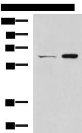 C6orf150 / MB21D1 Antibody - Western blot analysis of HT-29 and Lovo cell lysates  using CGAS Polyclonal Antibody at dilution of 1:400