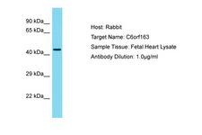 C6orf163 Antibody -  This image was taken for the unconjugated form of this product. Other forms have not been tested.