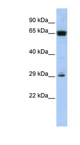 C6orf223 Antibody - C6orf223 antibody Western blot of Jurkat lysate. This image was taken for the unconjugated form of this product. Other forms have not been tested.