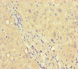C6orf223 Antibody - Immunohistochemistry of paraffin-embedded human liver tissue at dilution of 1:100