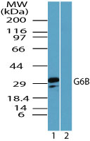 C6orf25 Antibody - Western blot of G6B in platelets in the 1) absence and 2) presence of immunizing peptide using Polyclonal Antibody to G6B at 0.5 ug/ml. Goat anti-rabbit Ig HRP secondary antibody, and PicoTect ECL substrate solution, were used for this test.