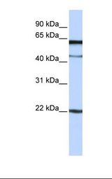 C6orf25 Antibody - Jurkat cell lysate. Antibody concentration: 1.0 ug/ml. Gel concentration: 12%.  This image was taken for the unconjugated form of this product. Other forms have not been tested.