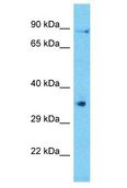 C6orf58 Antibody - C6orf58 antibody Western Blot of ACHN. Antibody dilution: 1 ug/ml.  This image was taken for the unconjugated form of this product. Other forms have not been tested.