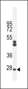 C6orf62 Antibody - CF062 Antibody western blot of CHO cell line lysates (35 ug/lane). The CF062 antibody detected the CF062 protein (arrow).