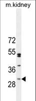 C6orf62 Antibody - CF062 Antibody western blot of mouse kidney tissue lysates (35 ug/lane). The CF062 antibody detected the CF062 protein (arrow).