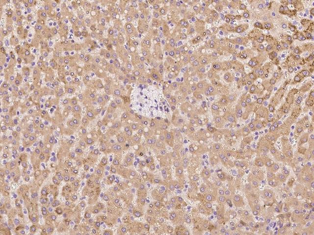 C6orf62 Antibody - Immunochemical staining of human C6orf62 in human liver with rabbit polyclonal antibody at 1:100 dilution, formalin-fixed paraffin embedded sections.