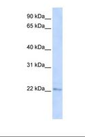 C6orf64 Antibody - 293T cell lysate. Antibody concentration: 1.0 ug/ml. Gel concentration: 12%.  This image was taken for the unconjugated form of this product. Other forms have not been tested.