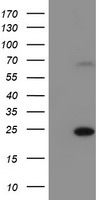 C6orf64 Antibody - HEK293T cells were transfected with the pCMV6-ENTRY control (Left lane) or pCMV6-ENTRY C6orf64 (Right lane) cDNA for 48 hrs and lysed. Equivalent amounts of cell lysates (5 ug per lane) were separated by SDS-PAGE and immunoblotted with anti-C6orf64.