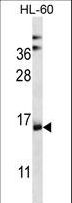 C6orf66 Antibody - NDUFAF4 Antibody western blot of HL-60 cell line lysates (35 ug/lane). The NDUFAF4 antibody detected the NDUFAF4 protein (arrow).
