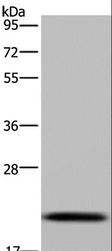 C6orf66 Antibody - Western blot analysis of Raji cell, using NDUFAF4 Polyclonal Antibody at dilution of 1:300.