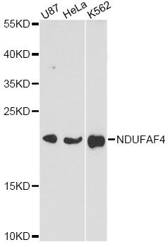 C6orf66 Antibody - Western blot analysis of extracts of various cell lines, using NDUFAF4 antibody at 1:3000 dilution. The secondary antibody used was an HRP Goat Anti-Rabbit IgG (H+L) at 1:10000 dilution. Lysates were loaded 25ug per lane and 3% nonfat dry milk in TBST was used for blocking. An ECL Kit was used for detection and the exposure time was 30s.