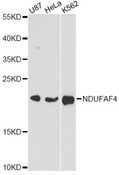 C6orf66 Antibody - Western blot analysis of extracts of various cell lines, using NDUFAF4 antibody at 1:3000 dilution. The secondary antibody used was an HRP Goat Anti-Rabbit IgG (H+L) at 1:10000 dilution. Lysates were loaded 25ug per lane and 3% nonfat dry milk in TBST was used for blocking. An ECL Kit was used for detection and the exposure time was 30s.