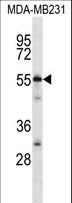 C7orf25 Antibody - CG025 Antibody western blot of MDA-MB231 cell line lysates (35 ug/lane). The CG025 antibody detected the CG025 protein (arrow).