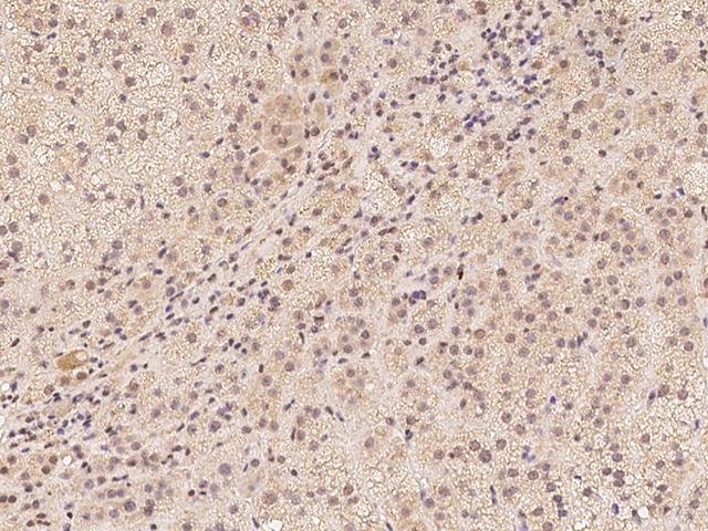 C7orf25 Antibody - Immunochemical staining of human C7orf25 in human adrenal gland with rabbit polyclonal antibody at 1:100 dilution, formalin-fixed paraffin embedded sections.
