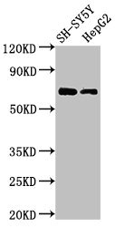 C7orf31 Antibody - Western Blot Positive WB detected in: SH-SY5Y whole cell lysate, HepG2 whole cell lysate All lanes: C7orf31 antibody at 2.5µg/ml Secondary Goat polyclonal to rabbit IgG at 1/50000 dilution Predicted band size: 69 kDa Observed band size: 69 kDa