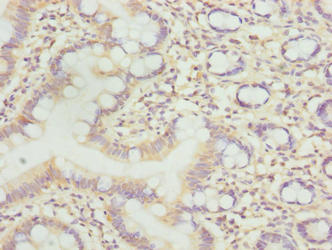 C7orf34 Antibody - Immunohistochemistry of paraffin-embedded human small intestine tissue using C7orf34 Antibody at dilution of 1:100