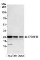 C7orf50 Antibody - Detection of human C7ORF50 by western blot. Samples: Whole cell lysate (25 µg) from HeLa, HEK293T, and Jurkat cells prepared using NETN lysis buffer. Antibody: Affinity purified rabbit anti-C7ORF50 antibody used for WB at 1 µg/ml. Detection: Chemiluminescence with an exposure time of 3 minutes.