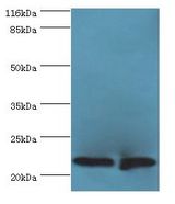 C7orf50 Antibody - Western blot. All lanes: C7orf50 antibody at 2 ug/ml Lane 1:A549 whole cell lysate. Lane 2: MCF-7 whole cell lysate. Secondary antibody: Goat polyclonal to rabbit at 1:10000 dilution. Predicted band size: 22 kDa. Observed band size: 22 kDa.  This image was taken for the unconjugated form of this product. Other forms have not been tested.
