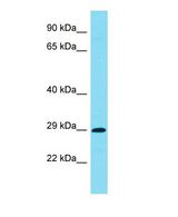 C7orf57 Antibody - Western blot of C7orf57 Antibody - C-terminal region with human Jurkat cells lysate.  This image was taken for the unconjugated form of this product. Other forms have not been tested.