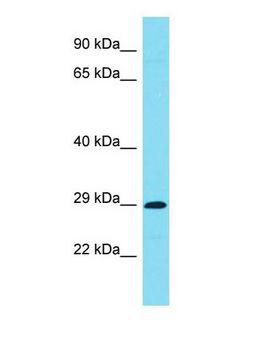 C7orf57 Antibody - Western blot of C7orf57 Antibody - C-terminal region with human Jurkat cells lysate.  This image was taken for the unconjugated form of this product. Other forms have not been tested.