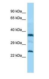 C7orf61 Antibody - C7orf61 antibody Western Blot of Jurkat.  This image was taken for the unconjugated form of this product. Other forms have not been tested.