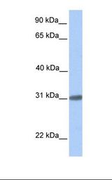 C7orf61 Antibody - Fetal brain lysate. Antibody concentration: 1.0 ug/ml. Gel concentration: 12%.  This image was taken for the unconjugated form of this product. Other forms have not been tested.