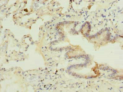 C7orf61 Antibody - Immunohistochemistry of paraffin-embedded human lung tissue using C7orf61 Antibody at dilution of 1:100