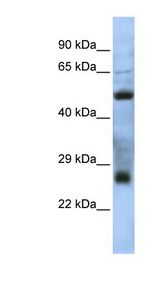 C7orf62 Antibody - C7orf62 antibody Western blot of Jurkat lysate. This image was taken for the unconjugated form of this product. Other forms have not been tested.