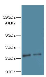 C7orf62 Antibody - Western blot. All lanes: C7orf62 antibody at 8 ug/ml. Lane 1: Jurkat whole cell lysate. Lane 2: A549 whole cell lysate. Secondary Goat polyclonal to Rabbit IgG at 1:10000 dilution. Predicted band size: 29 kDa. Observed band size: 29 kDa.