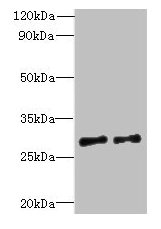 C7orf62 Antibody - Western blot All lanes: TEX47 antibody at 8µg/ml Lane 1: Jurkat whole cell lysate Lane 2: A549 whole cell lysate Secondary Goat polyclonal to rabbit IgG at 1/10000 dilution Predicted band size: 30 kDa Observed band size: 30 kDa