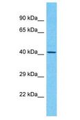 C7orf72 Antibody - C7orf72 antibody Western Blot of ACHN. Antibody dilution: 1 ug/ml.  This image was taken for the unconjugated form of this product. Other forms have not been tested.
