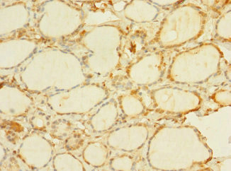 C8orf34 Antibody - Immunohistochemistry of paraffin-embedded human thyroid tissue using C8orf34 Antibody at dilution of 1:100