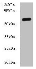 C8orf34 Antibody - Western Blot All lanes: C8orf34 antibody at 5µg/ml + Mouse skeletal muscle tissue Secondary Goat polyclonal to rabbit IgG at 1/10000 dilution Predicted band size: 51, 48, 33, 23, 15, 60 kDa Observed band size: 51 kDa