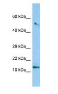 C8orf4 Antibody - C8orf4 antibody Western Blot of 293T.  This image was taken for the unconjugated form of this product. Other forms have not been tested.