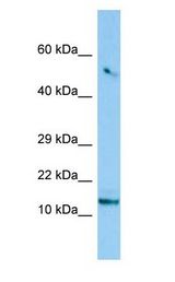 C8orf4 Antibody - C8orf4 antibody Western Blot of 293T.  This image was taken for the unconjugated form of this product. Other forms have not been tested.