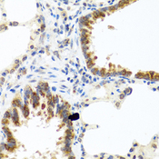 C8orf4 Antibody - Immunohistochemistry of paraffin-embedded rat lung tissue.