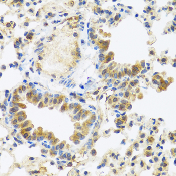 C8orf4 Antibody - Immunohistochemistry of paraffin-embedded mouse lung tissue.